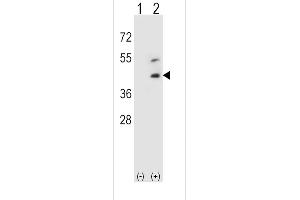 Western blot analysis of DCN using rabbit polyclonal DCN Antibody using 293 cell lysates (2 ug/lane) either nontransfected (Lane 1) or transiently transfected (Lane 2) with the DCN gene. (Decorin 抗体  (AA 122-150))