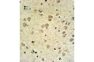 P4K3 Antibody (ABIN653817 and ABIN2843090) IHC analysis in forlin fixed and paraffin embedded brain tissue followed by peroxidase conjugation of the secondary antibody and DAB staining. (MAP4K3 抗体)