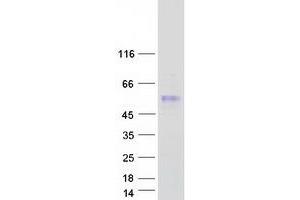Validation with Western Blot (SERPINA11 Protein (Myc-DYKDDDDK Tag))