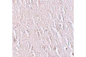Immunohistochemistry (IHC) image for anti-Zinc Finger and BTB Domain Containing 5 (ZBTB5) (C-Term) antibody (ABIN1030813) (ZBTB5 抗体  (C-Term))
