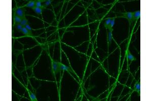 Immunofluorescent staining of differentiated SH-SY5Y cells (right). (SNRPN 抗体  (AA 14-174))