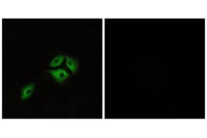 Immunofluorescence analysis of A549 cells, using NMBR antibody. (NMBR 抗体  (Internal Region))