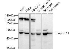 Western blot analysis of extracts of various cell lines, using Septin 11 antibody (ABIN6129126, ABIN6147548, ABIN6147550 and ABIN6215781) at 1:4890 dilution. (Septin 11 抗体  (AA 1-120))