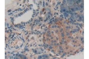 Immunohistochemistry (IHC) image for anti-Lactoperoxidase (LPO) (AA 351-589) antibody (ABIN7437911)
