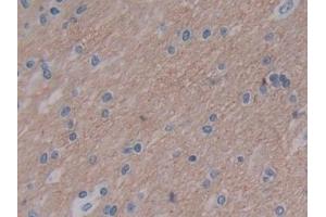 Detection of VSNL1 in Human Cerebrum Tissue using Polyclonal Antibody to Visinin Like Protein 1 (VSNL1) (VSNL1 抗体  (AA 39-184))