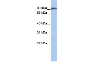 WB Suggested Anti-GTSE1 Antibody Titration:  0.