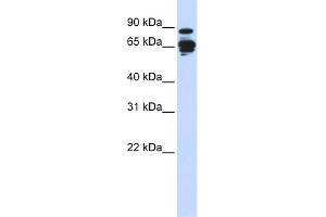 WB Suggested Anti-AMPH Antibody Titration: 0. (Amphiphysin 抗体  (N-Term))