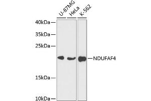 Western blot analysis of extracts of various cell lines, using NDUF antibody (ABIN7268807) at 1:3000 dilution. (NDUFAF4 抗体  (AA 1-170))