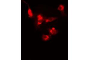 ABIN6272361 staining Hela by IF/ICC. (NFRKB 抗体)
