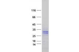 Western Blotting (WB) image for Signaling threshold Regulating Transmembrane Adaptor 1 (SIT1) protein (Myc-DYKDDDDK Tag) (ABIN2732086)