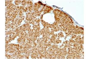 Formalin-fixed, paraffin-embedded human Parathyroid stained with PTH Mouse Recombinant Monoclonal Antibody (rPTH/911). (Recombinant PTH 抗体  (AA 1-34))