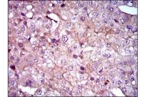 Image no. 1 for anti-Sonic Hedgehog (SHH) antibody (ABIN1491290) (Sonic Hedgehog 抗体)