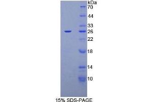 SDS-PAGE analysis of Human CA125 Protein. (MUC16 蛋白)
