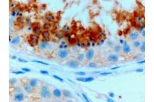 Image no. 1 for anti-Glutathione Peroxidase 4 (GPX4) (C-Term), (Isoform A) antibody (ABIN374711) (GPX4 抗体  (C-Term, Isoform A))