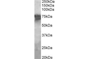 ABIN2564412 (2µg/ml) staining of Human Liver lysate (35µg protein in RIPA buffer). (PEPCK 抗体  (Internal Region))