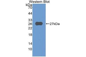 Western blot analysis of the recombinant protein. (ADAM8 抗体  (AA 371-587))