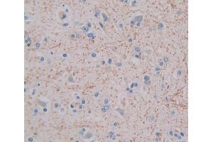 Used in DAB staining on fromalin fixed paraffin- embedded brain tissue (GHRHR 抗体  (AA 23-130))