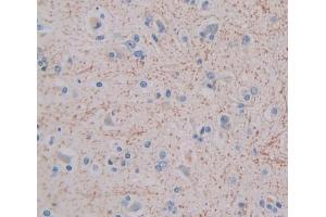 Used in DAB staining on fromalin fixed paraffin- embedded brain tissue (GHRHR 抗体  (AA 23-130))