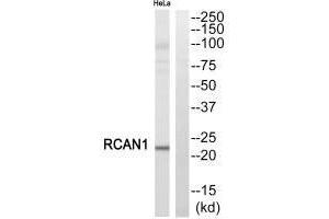 Western blot analysis of extracts from HeLa cells, using RCAN1 antibody. (RCAN1 抗体  (C-Term))