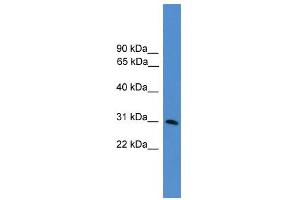 WB Suggested Anti-GTF2E2 Antibody Titration:  0.