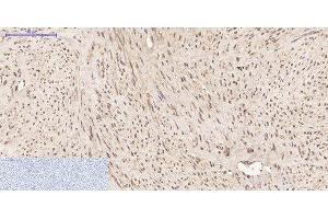 Immunohistochemistry of paraffin-embedded Human uterus tissue using PPIB Monoclonal Antibody at dilution of 1:200. (PPIB 抗体)