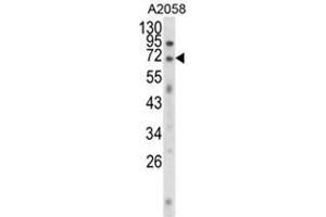 Western blot analysis of EWSR1 Antibody (C-term) in A2058 cell line lysates (35ug/lane). (EWSR1 抗体  (C-Term))
