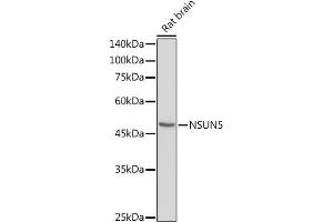 Western blot analysis of extracts of Rat brain, using NSUN5 antibody (ABIN7268955) at 1:1000 dilution. (NSUN5 抗体  (AA 277-466))
