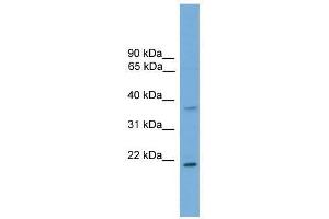 GSTM1 antibody used at 0. (GSTM1 抗体  (C-Term))