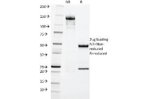 SDS-PAGE Analysis Purified Cytokeratin 20 (KRT20) Mouse Monoclonal Antibody (KRT20/1992).