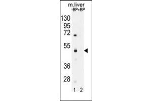 Western blot analysis of SAMD8 Antibody (N-term) Cat. (SAMD8 抗体  (N-Term))