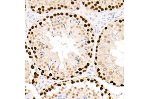 Immunohistochemistry (IHC) image for anti-Proliferating Cell Nuclear Antigen (PCNA) antibody (ABIN6139020)