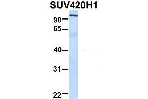 Western Blotting (WB) image for anti-Suppressor of Variegation 4-20 Homolog 1 (SUV420H1) (Middle Region) antibody (ABIN2775877)