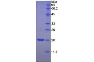 SDS-PAGE analysis of Human MYL2 Protein.