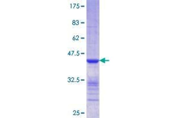 CLIC5 Protein (AA 91-190) (GST tag)