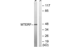 Western blot analysis of extracts from Jurkat cells, using MTERF antibody. (MTERF 抗体  (Internal Region))