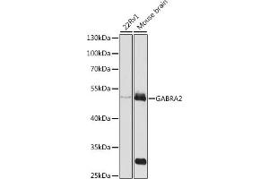 Western Blotting (WB) image for anti-gamma-aminobutyric Acid (GABA) A Receptor, alpha 2 (GABRA2) (AA 300-400) antibody (ABIN3022576)
