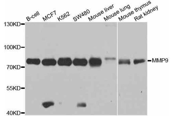MMP 9 抗体  (AA 538-707)