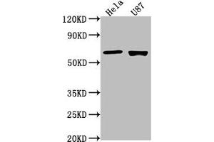 Western Blot Positive WB detected in: Hela whole cell lysate, U87 whole cell lysate All lanes: USP17L1 antibody at 1:2000 Secondary Goat polyclonal to rabbit IgG at 1/50000 dilution Predicted band size: 60 kDa Observed band size: 60 kDa (USP17L1 抗体  (C-Term))