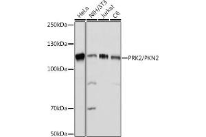 Western blot analysis of extracts of various cell lines, using PRK2/PRK2/PKN2 Rabbit mAb (ABIN7269646) at 1:1000 dilution. (PKN2 抗体)