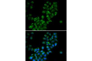 Immunofluorescence analysis of HeLa cells using CANT1 antibody (ABIN5973753). (CANT1 抗体)