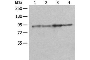 Western blot analysis of Rat brain tissue Mouse brain tissue A549 and PC-3 cell lysates using DDX1 Polyclonal Antibody at dilution of 1:300 (DDX1 抗体)