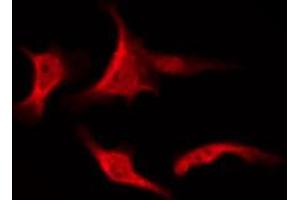 Immunofluorescence (fixed cells) (IF/ICC) image for anti-Protein Kinase C, zeta (PRKCZ) (pThr410) antibody (ABIN6256558)