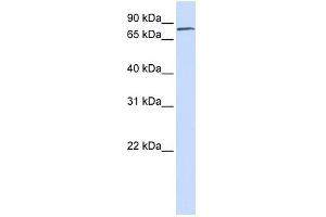 FERMT1 antibody used at 1 ug/ml to detect target protein. (FERMT1 抗体)