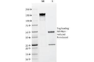 SDS-PAGE Analysis Purified FGF23 Mouse Monoclonal antibody (FGF23/638). (FGF23 抗体)