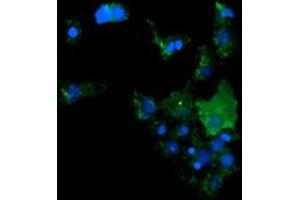 Image no. 2 for anti-Cancer/testis Antigen 1B (CTAG1B) antibody (ABIN1499900) (CTAG1B 抗体)
