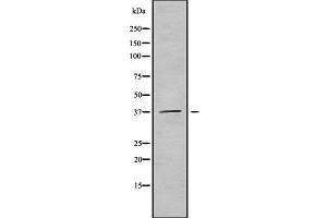 Western blot analysis of B3GALT6 using HuvEc whole cell lysates (B3GALT6 抗体  (Internal Region))