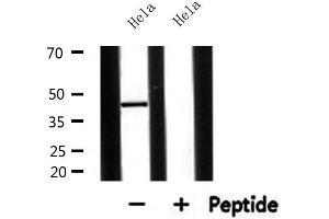 Western blot analysis of extracts from Hela, using AGPAT5 Antibody. (AGPAT5 抗体  (Internal Region))