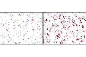 Immunohistochemistry (IHC) image for anti-Green Fluorescent Protein (GFP) antibody (ABIN1843725) (GFP 抗体)