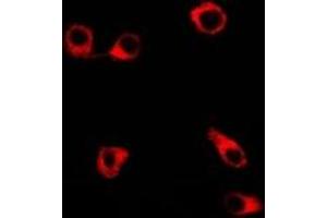 Immunofluorescent analysis of Clusterin staining in SW480 cells. (Clusterin 抗体)
