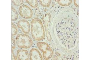 Immunohistochemistry of paraffin-embedded human kidney tissue using ABIN7159567 at dilution of 1:100 (MTX2 抗体  (AA 1-263))